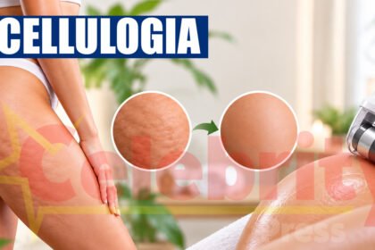 Cellulogia